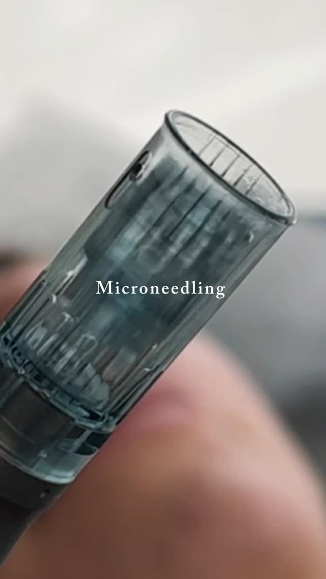 MAesthetics Skin Atelier Calgary Result 15