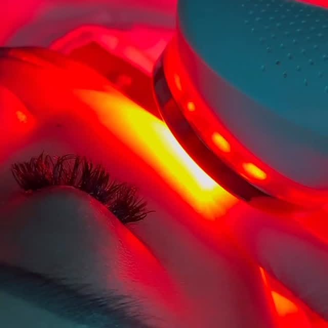 MAesthetics Skin Atelier Calgary Result 5